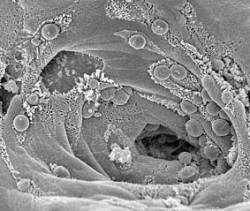 Cryptosporidium感染マウス腸管の走査電子顕微鏡像の画像