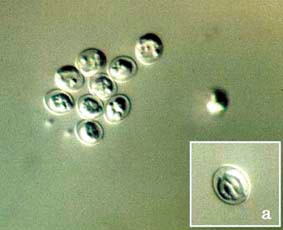 Cryptosporidium parvumオーシストの微分干渉像の画像
